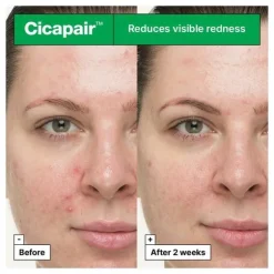 Cicapair So Soothing Treatment