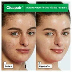 Cicapair Tiger Grass Color Correcting Treatment
