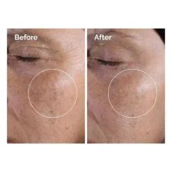 Glycolic Acid 7% Exfoliating Toner