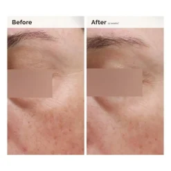 Niacinamide 5% Face & Body Emulsion